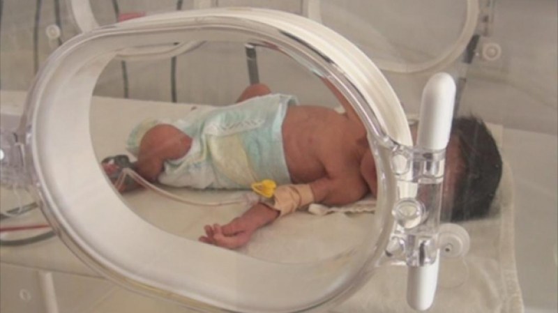 В Пловдив се роди бебе без бъбреци и почина