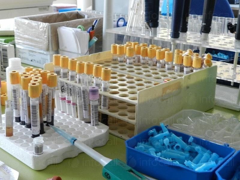 Спад на заболелите от варицела в Пловдивско