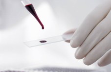 aktualno-hematologiiata-plovdiv-080.jpg