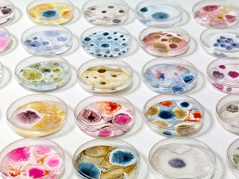 Студенти по медицина от Пловдив превърнаха бактерии и гъбички в изкуство