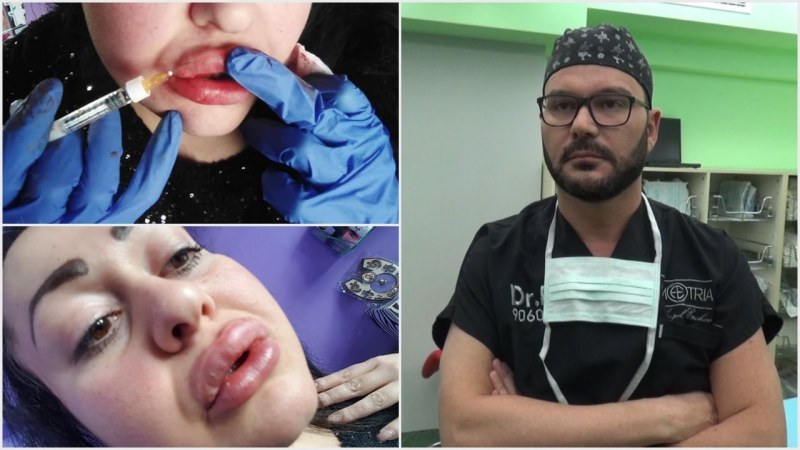 Заради лайкове, жена публикува снимки как сама си инжектира хиалурон в устните