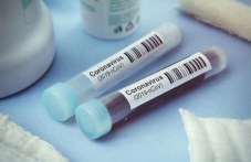zarazen-koronavirus-se-pribra-pri-685.jpg