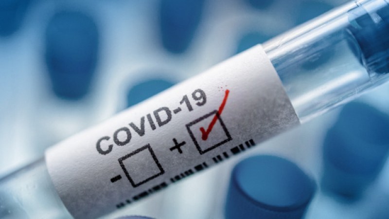 41 нови случая на коронавирус и пет жертви през последното денонощие