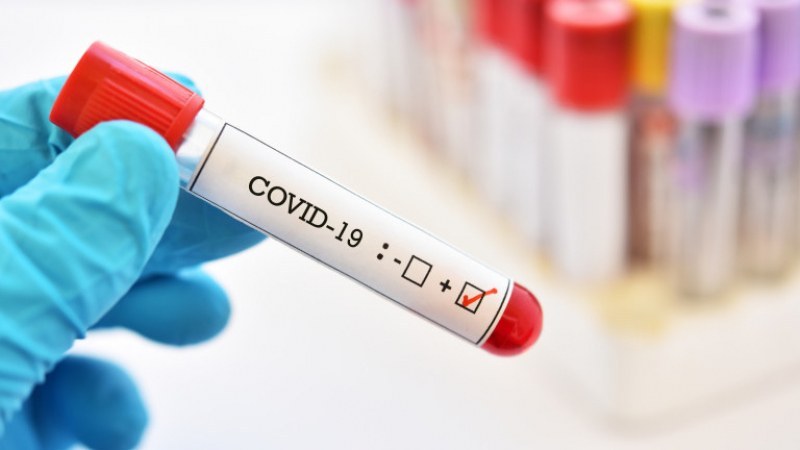 165 нови случаи на коронавирус, в Пловдив - рекорд на заразените