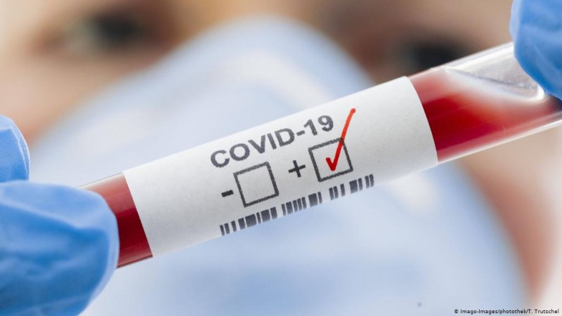 Още 180 заразени с коронавирус у нас, 11 в Пловдив