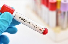 174-novi-sluchai-koronavirus-13-473.jpg