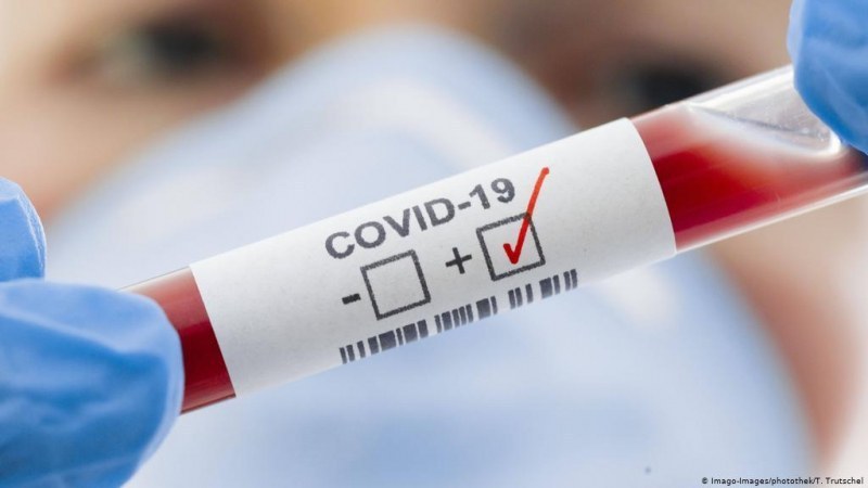 Два нови случая на коронавирус в Карловско, заразени са жени