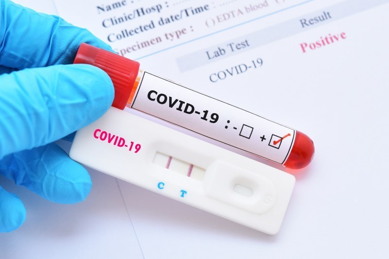 Пак скок: 210 нови случая на коронавирус, много са заразените и в Пловдивско