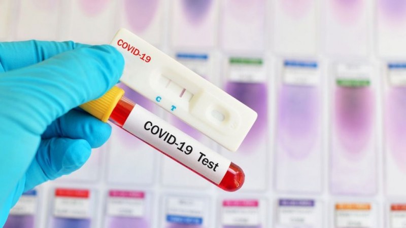 Нова PCR лаборатория ще заработи скоро в Пловдив