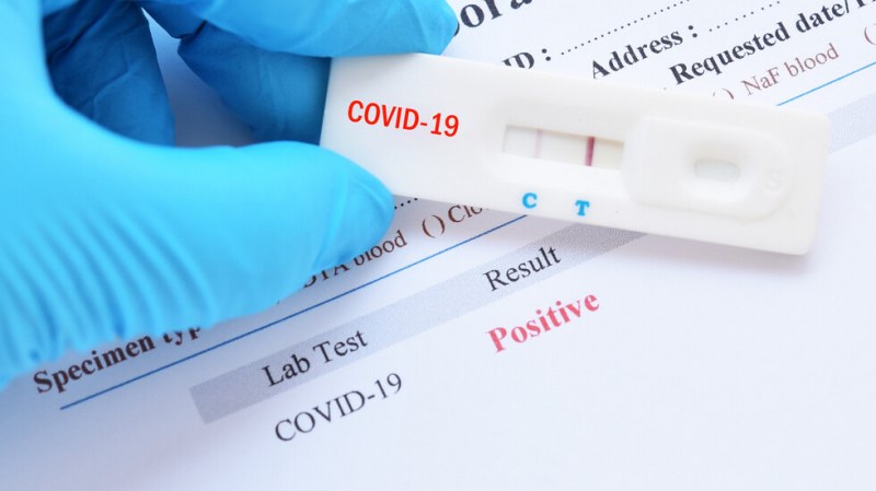 За месец: Едва 805 PCR теста e платила Касата на пловдивските болници и лаборатории