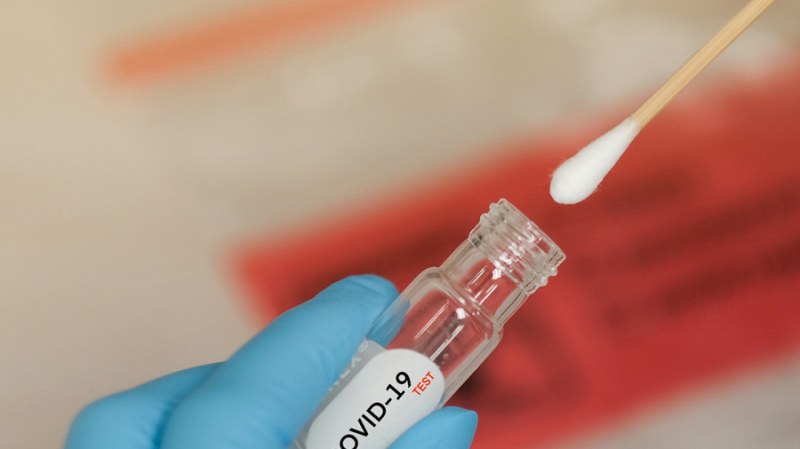 Отпадат PCR тестовете за постъпване в ковид отделения, променят и зелените коридори