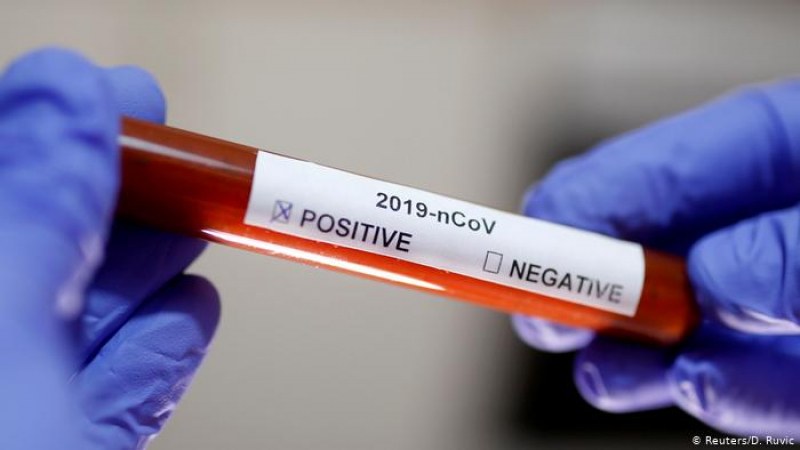 Първият случай на коронавирус в България е от края на януари