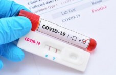 priravniavat-antigennite-testove-u-nas-201.jpg