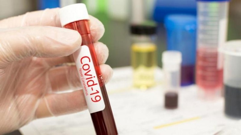 35 човека са изгубили битката с COVID-19 у нас за последното денонощие