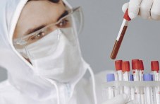 samo-332-novi-sluchai-koronavirus-u-nas-833.jpg