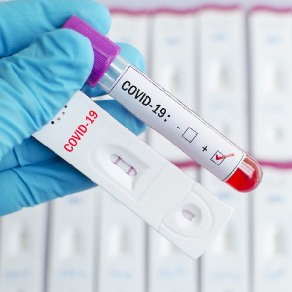 Над 13 000 изтеглени сертификати от преболедували с антигенен ковид тест