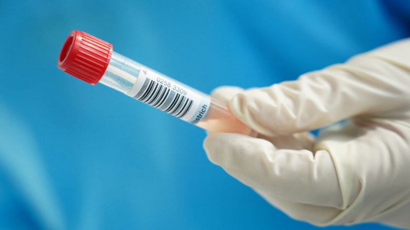 Тестовете за антитела не са достатъчен показател дали протича инфекция