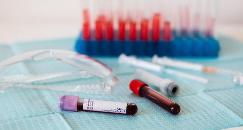 Кръвните проби за алкохол ще се изследват в лабораторията на ОД на МВР