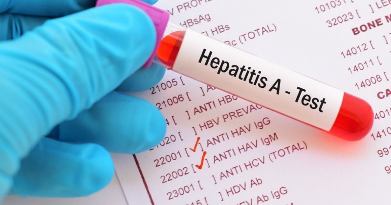 Безплатни тестове за хепатит В и С в Пловдив