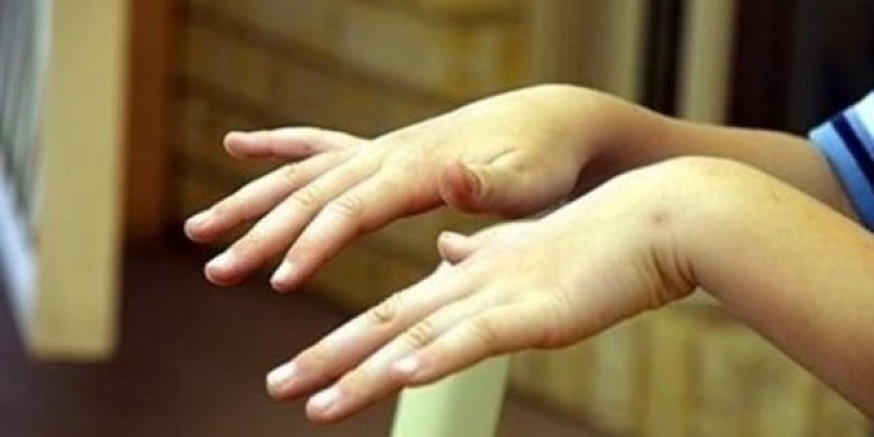 Треморът - чест симптом и проява на различни заболявания