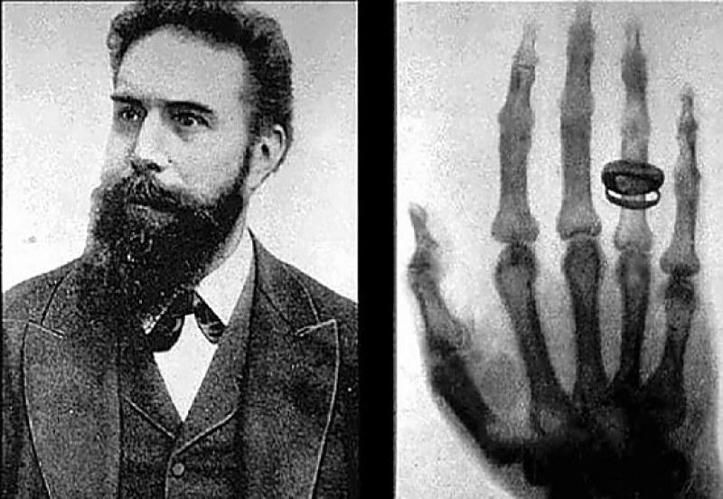 На този ден: Направена е първата рентгенова снимка