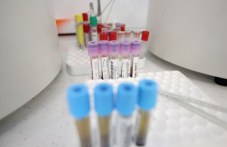 133-sa-novite-sluchai-koronavirus-u-nas-737.jpg
