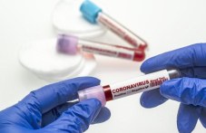 30-novi-sluchaia-koronavirus-u-nas-5-sa-422.jpg
