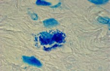nova-obrazna-diagnostika-otkriva-raka-082.jpg