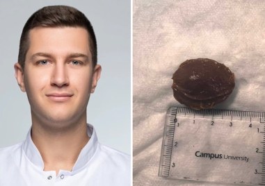Лекари от Пловдив спасиха пациент след заседнала костилка в хранопровода