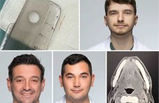 Лекари спасиха мъж с рядко и опасно усложнение от рибена кост в Пловдив