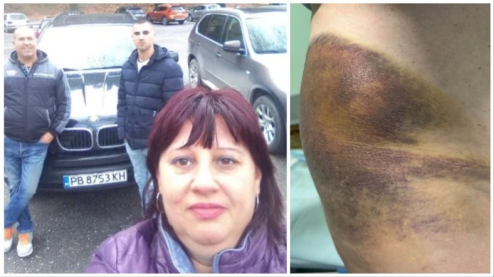 Бащата на кмета на Цалапица пред съда за побой над сватята – тя твърди, че е изхвърлена пред кофи за боклук