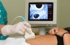 Пловдив отчита драматично увеличение на абортите