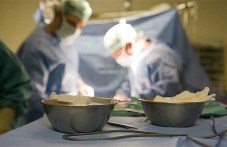 20 години от първата в света трансплантация на лице