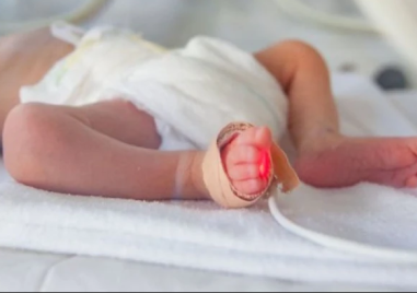 Лекари спасиха живота на бебе с чудовищно високи левкоцити