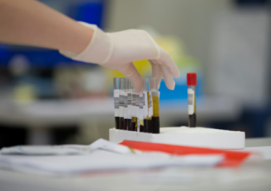 Търсят доброволци за участие в националния проект „Геномът на България“