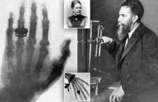 На този ден: Направена е първата рентгенова снимка