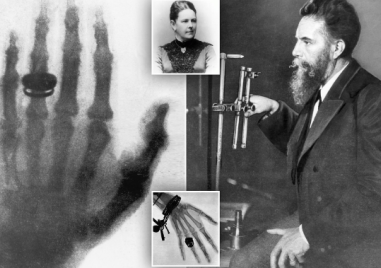 На този ден: Направена е първата рентгенова снимка