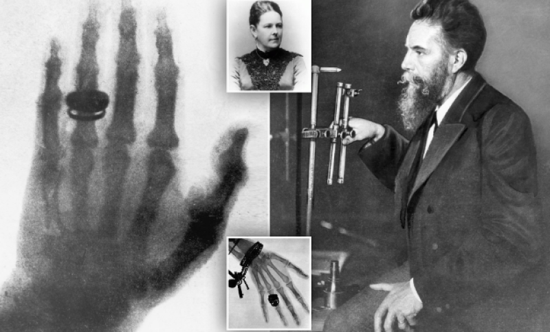 На този ден: Направена е първата рентгенова снимка