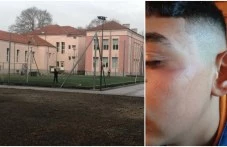 Експерти на РУО-Пловдив извършиха проверка за случая с посинения ученик в Пловдивско