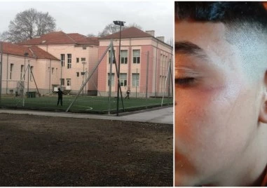 Експерти на РУО-Пловдив извършиха проверка за случая с посинения ученик в Пловдивско