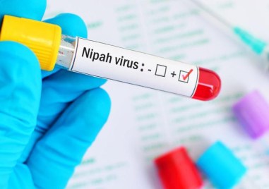 Пловдивски лекар обяснява защо вирусът Нипа е опасен и как се разпространява