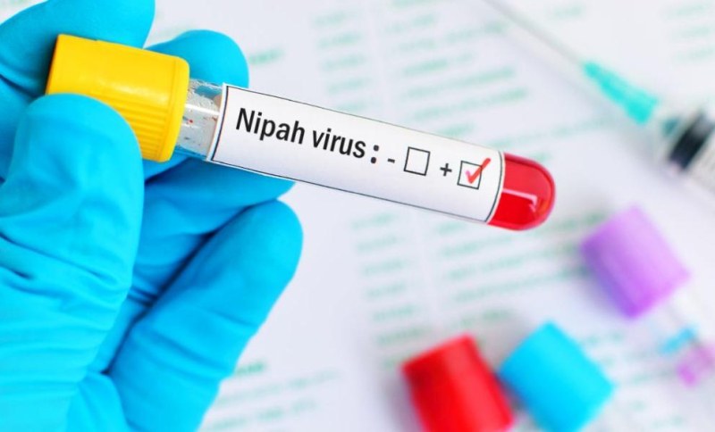 Пловдивски лекар обяснява защо вирусът Нипа е опасен и как се разпространява