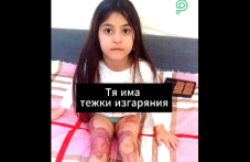 Малката Катя е с тежки изгаряния и има нужда от помощ
