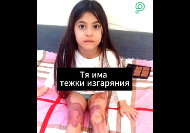 Малката Катя е с тежки изгаряния и има нужда от помощ