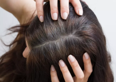 Някои храни забавят побелявянето на косата