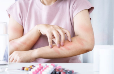 Сезонът на алергиите започва по-рано тази година