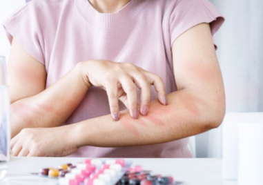 Сезонът на алергиите започва по-рано тази година