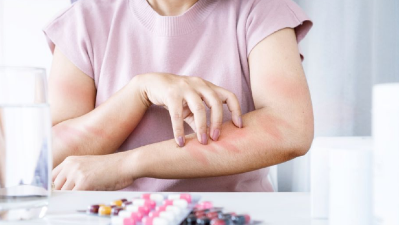 Сезонът на алергиите започва по-рано тази година