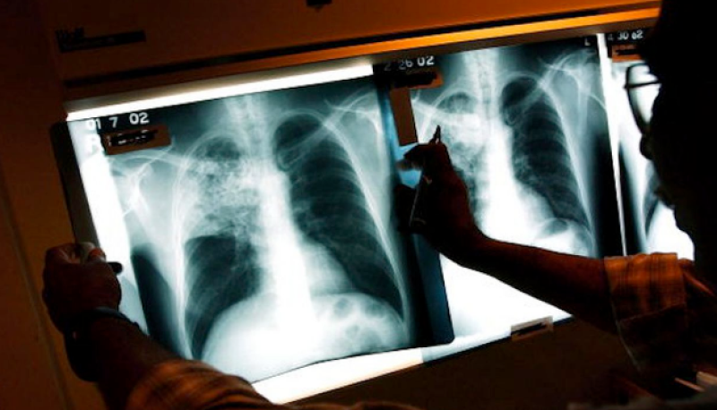 24 март - Световен ден за борба с туберкулозата