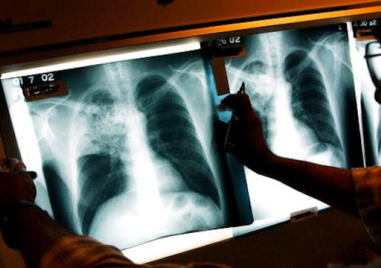 24 март - Световен ден за борба с туберкулозата